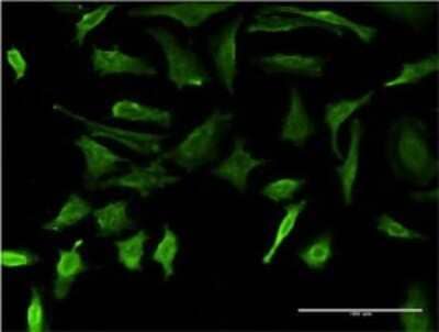 Immunocytochemistry/ Immunofluorescence: DMP-1 Antibody (1D4) [H00001758-M01]