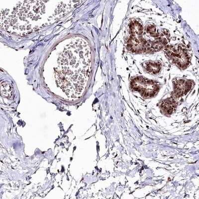 Immunohistochemistry-Paraffin: DMP-1 Antibody [NBP1-89484]