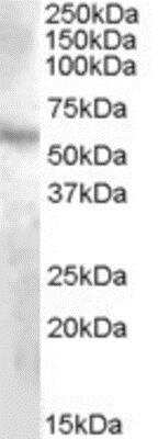 Western Blot: DMP-1 Antibody [NBP1-20908]