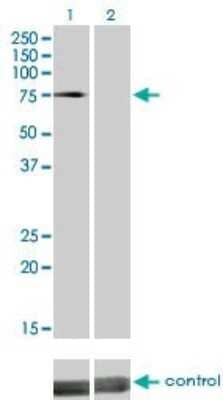 Western Blot: DMPK Antibody (2F7) [H00001760-M01]