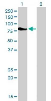 Western Blot: DMPK Antibody (2F7) [H00001760-M01]