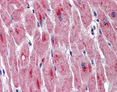 Immunohistochemistry-Paraffin: DMPK Antibody [NBP1-57584]