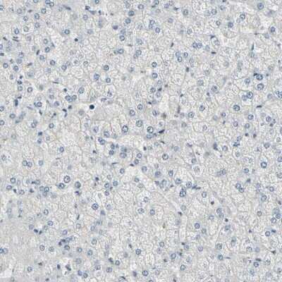 Immunohistochemistry-Paraffin: DMPK Antibody [NBP1-85010]