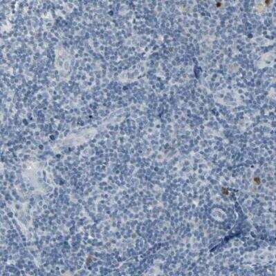 Immunohistochemistry-Paraffin: DMPK Antibody [NBP1-85010]