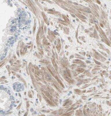 Immunohistochemistry-Paraffin: DMPK Antibody [NBP1-85010]
