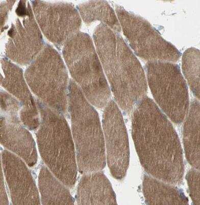 Immunohistochemistry-Paraffin: DMPK Antibody [NBP1-85010]