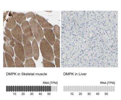 Immunohistochemistry-Paraffin: DMPK Antibody [NBP1-85010]