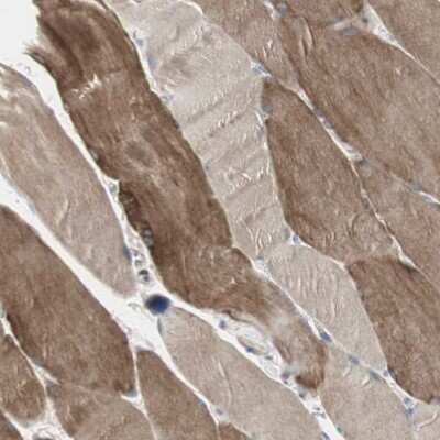 Immunohistochemistry-Paraffin: DMPK Antibody [NBP1-85011]