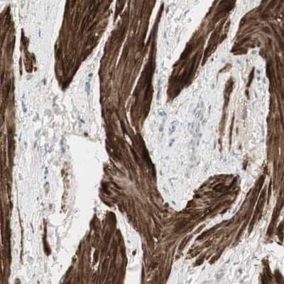 Immunohistochemistry-Paraffin: DMPK Antibody [NBP1-85011]