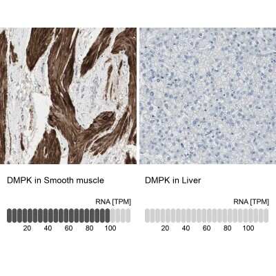 Immunohistochemistry-Paraffin: DMPK Antibody [NBP1-85011]