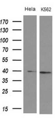 Western Blot: DMRT1 Antibody (OTI1G10) [NBP2-46464]