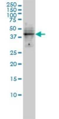 Western Blot: DMRT1 Antibody (1G11) [H00001761-M01]