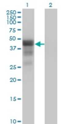 Western Blot: DMRT1 Antibody (1G11) [H00001761-M01]