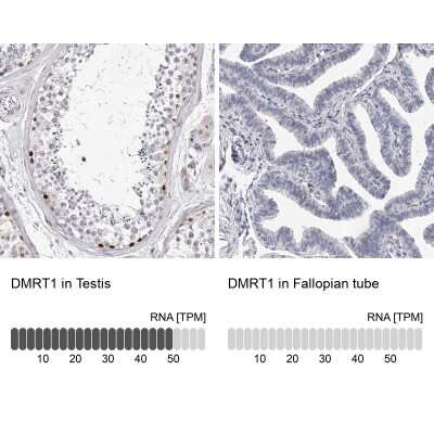 Immunohistochemistry-Paraffin: DMRT1 Antibody [NBP1-84071]