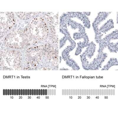 Immunohistochemistry-Paraffin: DMRT1 Antibody [NBP1-84071]