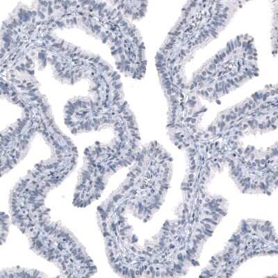 Immunohistochemistry-Paraffin: DMRT1 Antibody [NBP1-84071]