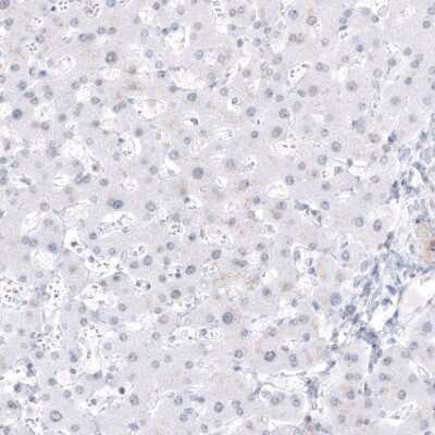 Immunohistochemistry-Paraffin: DMRT1 Antibody [NBP1-84071]