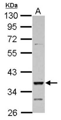 Western Blot: DMRT1 Antibody [NBP2-16179]