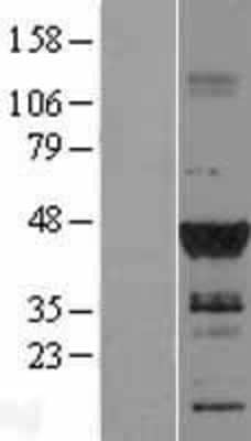 Western Blot: DMRT1 Overexpression Lysate [NBL1-09925]