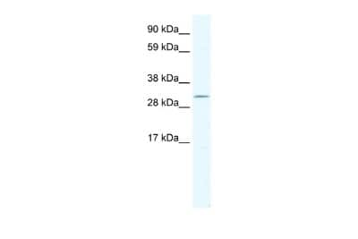 Western Blot: DMRT2 Antibody [NBP2-82870]