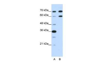 Western Blot: DMRT2 Antibody [NBP2-82871]