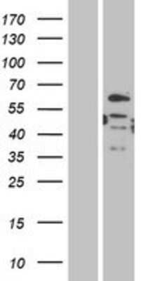 Western Blot: DMRT2 Overexpression Lysate [NBP2-04871]