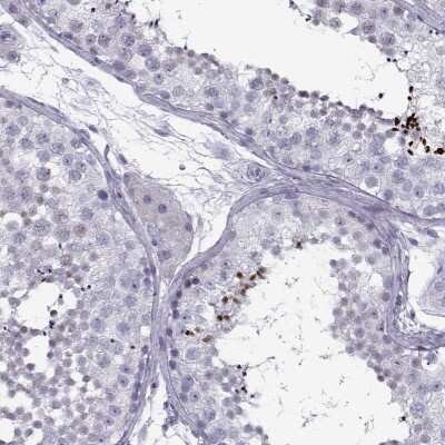 Immunohistochemistry-Paraffin: DMRT3 Antibody [NBP2-69049]