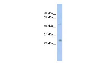 Western Blot: DMRT3 Antibody [NBP2-82872]