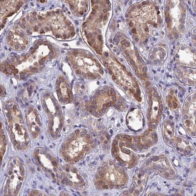 Immunohistochemistry-Paraffin: DMRTA1 Antibody [NBP1-91838]
