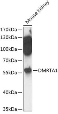 Western Blot: DMRTA1 AntibodyAzide and BSA Free [NBP2-92155]