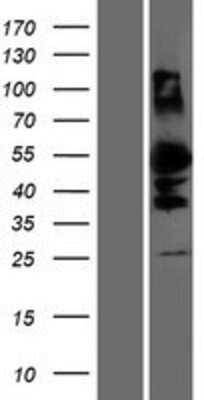 Western Blot: DMRTA1 Overexpression Lysate [NBP2-06454]