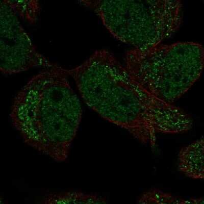 Immunocytochemistry/ Immunofluorescence: DMRTA2 Antibody [NBP2-57095]