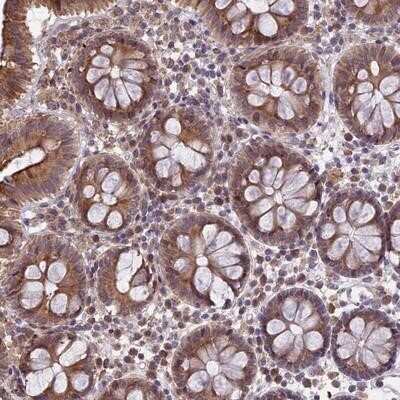 Immunohistochemistry-Paraffin: DMRTA2 Antibody [NBP1-85830]