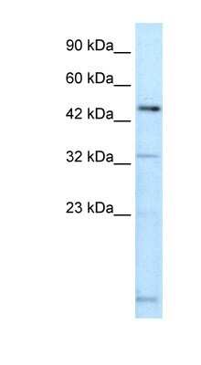 Western Blot: DMRTA2 Antibody [NBP1-80019]