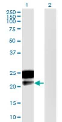 Western Blot: DMRTB1 Antibody (5E7) [H00063948-M02]