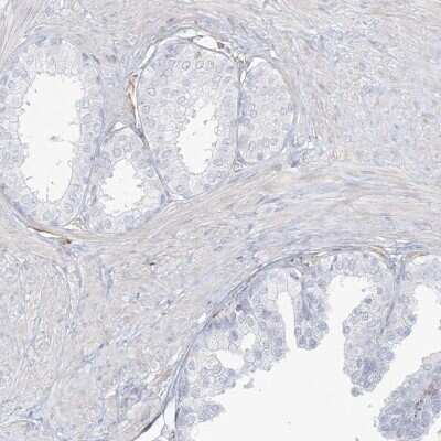 Immunohistochemistry-Paraffin: DMRTB1 Antibody [NBP1-86287]