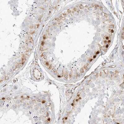 Immunohistochemistry-Paraffin: DMRTB1 Antibody [NBP1-86287]
