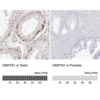 Immunohistochemistry-Paraffin: DMRTB1 Antibody [NBP1-86287]