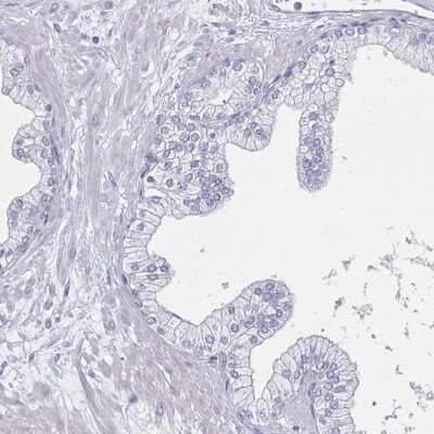 Immunohistochemistry-Paraffin: DMRTB1 Antibody [NBP2-32390]