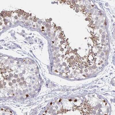Immunohistochemistry-Paraffin: DMRTB1 Antibody [NBP2-32390]