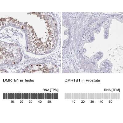 Immunohistochemistry-Paraffin: DMRTB1 Antibody [NBP2-32390]