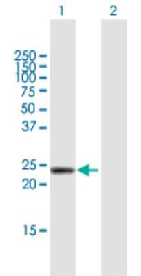 Western Blot: DMRTB1 Antibody [H00063948-B02P]