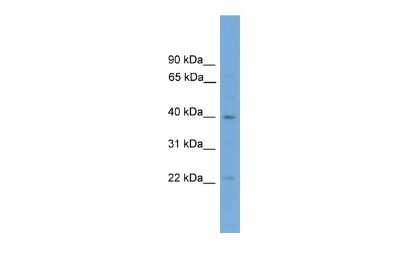 Western Blot: DMRTB1 Antibody [NBP3-10450]