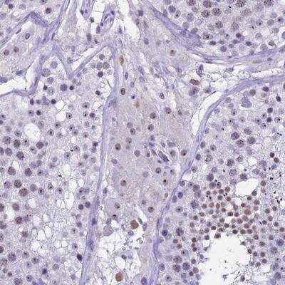 Immunohistochemistry-Paraffin: DMRTC2 Antibody [NBP1-91839]