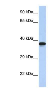 Western Blot: DMRTC2 Antibody [NBP1-80128]