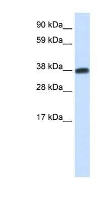 Western Blot: DMRTC2 Antibody [NBP1-80248]