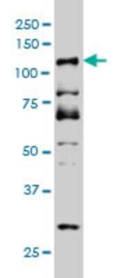 Western Blot: DMTF1 Antibody (5C6) [H00009988-M03]