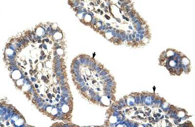 Immunohistochemistry: DMTF1 Antibody [NBP3-10334]