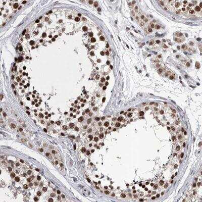 Immunohistochemistry-Paraffin: DMTF1 Antibody [NBP1-84073]