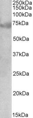 Western Blot: DMTF1 Antibody [NBP2-26209]